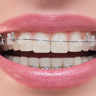 Ортодонтия