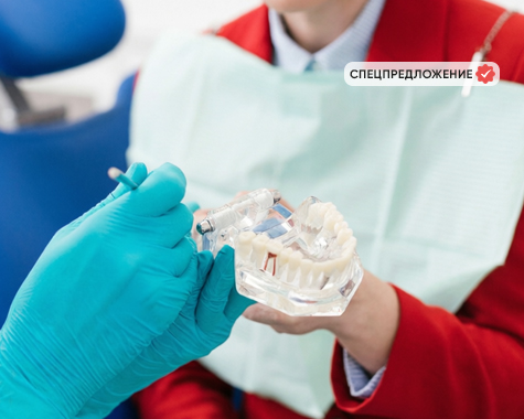 Имплант премиум класса Osstem (Южная Корея) с коронкой &laquo;под ключ&raquo;