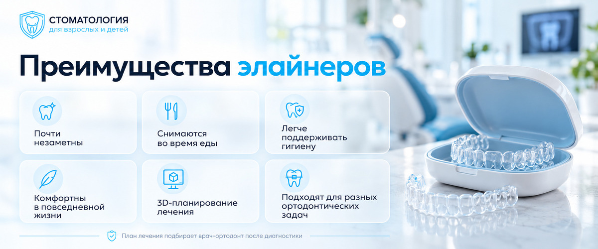 Преимущества элайнеров для выравнивания зубов - Стоматология у метро Щелковская и Первомайская