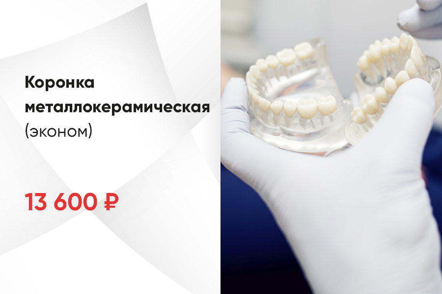 Акция в стоматологии у метро Щелковская и Первомайская